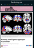 Kunstig intelligens oppdager Alzheimer