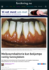 Melkesyrebakterie kan bekjempe vanlig tannsykdom