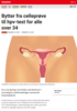 Nyheter Bytter fra celleprøve til hpv-test for alle over 34