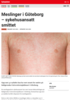 Nyheter Meslinger i Göteborg - sykehusansatt smittet