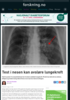 Test i nesen kan avsløre lungekreft